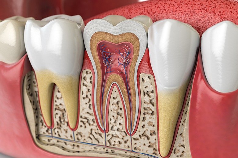 Invisalign for improving dental alignment