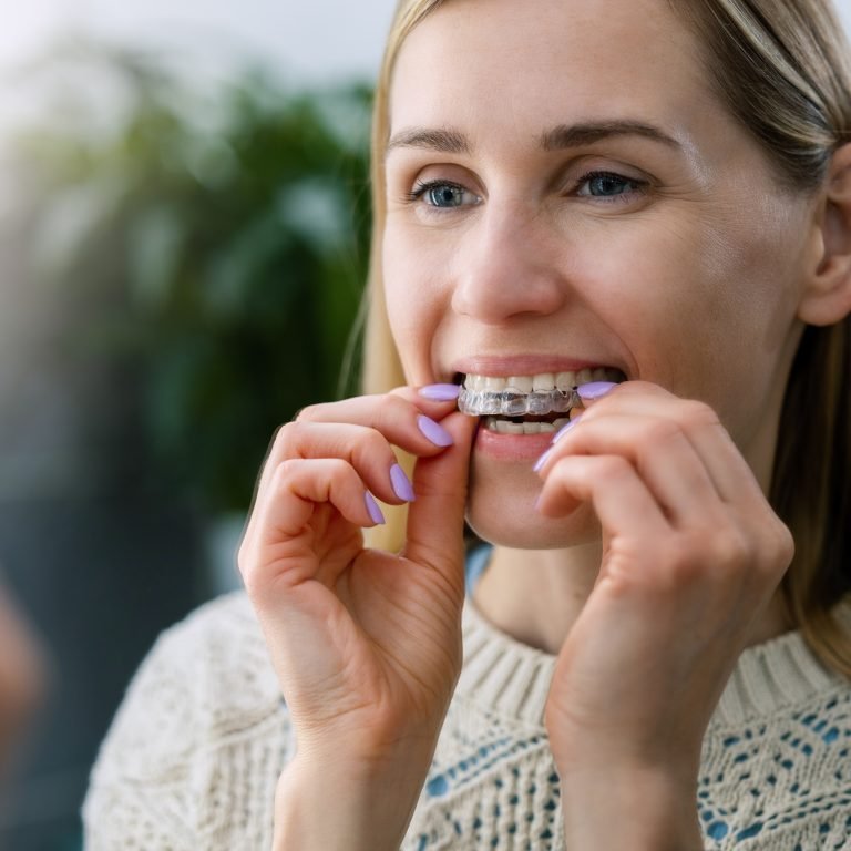 Can Invisalign Work Even If Your Teeth Are Severely Crowded?