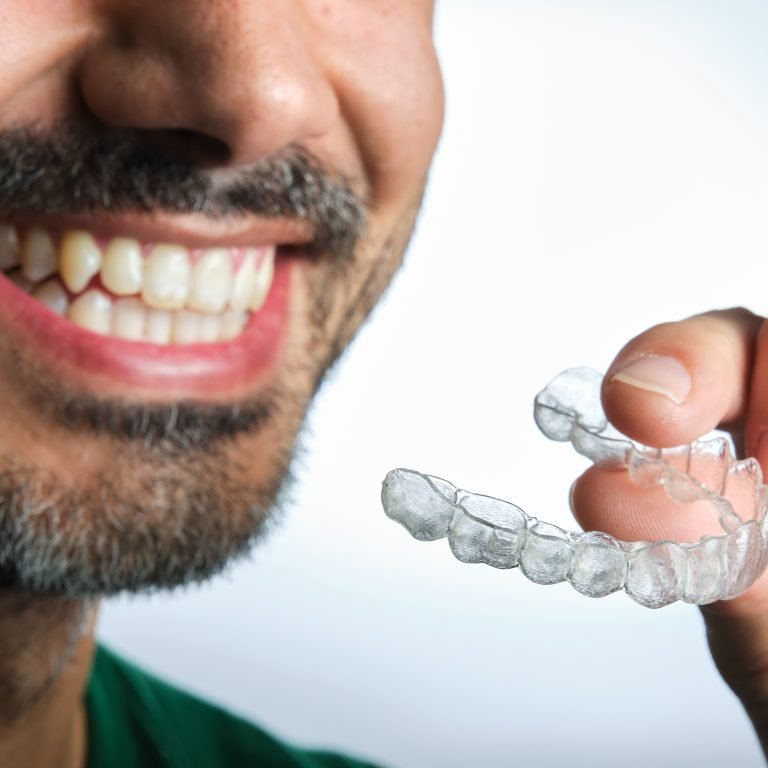 man with transparent dental retainer